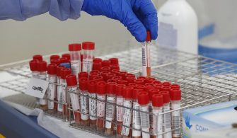 sahtepcrtestiveaşıkartı