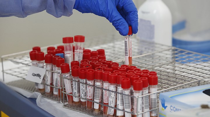 Sahte Aşı Kartı Veya ‘PCR’ Kullanmanın Cezası Var Mıdır?